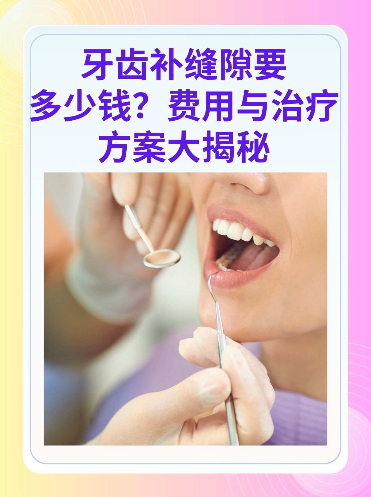 广元补牙医保可以报销吗(补牙医保可以报销吗 哪些可以报销呢)